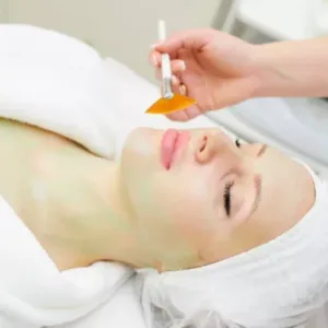 Chemical peel facial treatment in Novi, MI