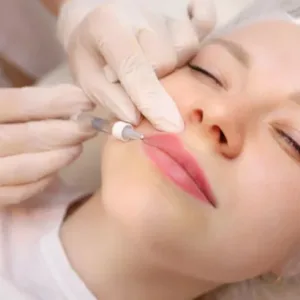 Juvederm dermal filler treatment in Novi, MI